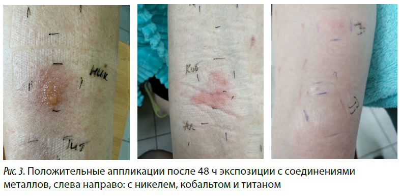 Изображение на обложке